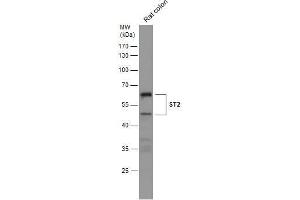 WB Image Rat tissue extract (50 μg) was separated by 10% SDS-PAGE, and the membrane was blotted with ST2 antibody [N1C1] , diluted at 1:500.