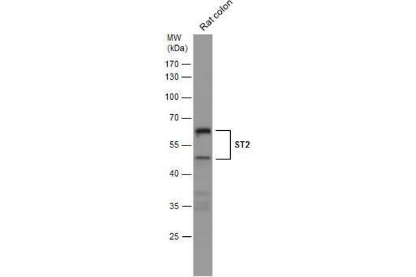 anti-Interleukin 1 Receptor-Like 1 (IL1RL1) (Center) antibody