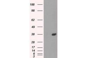 Image no. 9 for anti-Fc gamma RII (CD32) antibody (ABIN1497254)