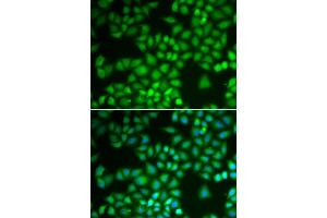 Image no. 3 for anti-Nuclear Factor of kappa Light Polypeptide Gene Enhancer in B-Cells 1 (NFKB1) antibody (ABIN6144571)