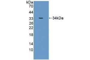 CRAT Antikörper  (AA 363-626)