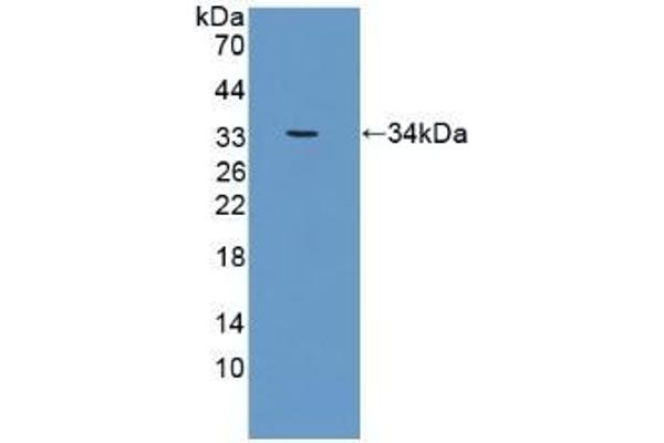 CRAT anticorps  (AA 363-626)