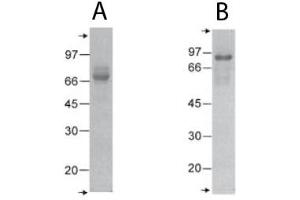 Cartilage Oligomeric Matrix Protein (COMP) (C-Term) protein
