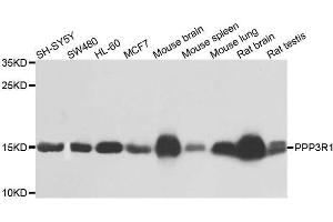Image no. 2 for anti-Protein Phosphatase 3, Regulatory Subunit B, alpha (PPP3R1) antibody (ABIN1682270)