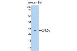 Image no. 1 for anti-Keratin 4 (KRT4) (AA 317-454) antibody (ABIN1172975)