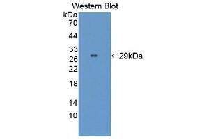 Image no. 1 for anti-Pericentriolar Material 1 (PCM1) (AA 15-210) antibody (ABIN5014076)