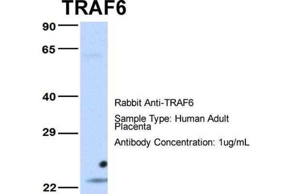 anti-TNF Receptor-Associated Factor 6 (TRAF6) (Middle Region) antibody