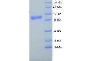 Erythroferrone (ERFE) (AA 25-340) protein (His tag)