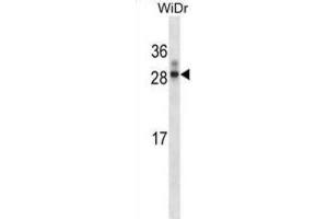Western Blotting (WB) image for anti-Homeobox A7 (HOXA7) antibody (ABIN2998012)
