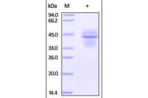 Image no. 2 for Interleukin 12 (IL12) (AA 23-328) (Active) protein (His tag,DYKDDDDK Tag) (ABIN2181328)