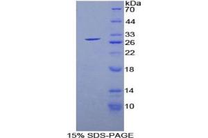 Image no. 5 for Glutathione S-Transferase alpha 1 (GSTA1) ELISA Kit (ABIN6574174)