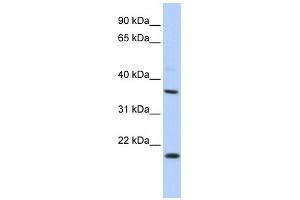 Image no. 1 for anti-Potassium Large Conductance Calcium-Activated Channel, Subfamily M beta Member 3 (KCNMB3) (Middle Region) antibody (ABIN633743)