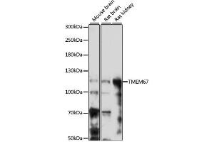 Image no. 1 for anti-Transmembrane Protein 67 (TMEM67) antibody (ABIN6293383)