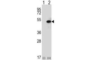 Image no. 4 for anti-Sphingosine Kinase 1 (SPHK1) (AA 313-343) antibody (ABIN3032708)