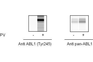 Image no. 1 for C-Abl Oncogene 1, Non-Receptor tyrosine Kinase (ABL1) ELISA Kit (ABIN6730567)
