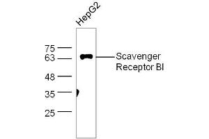 Image no. 4 for anti-Scavenger Receptor Class B, Member 1 (SCARB1) (AA 21-100) antibody (ABIN738936)