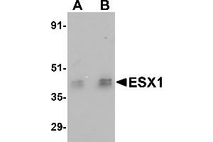 Image no. 2 for anti-ESX Homeobox 1 (ESX1) (Middle Region) antibody (ABIN1030926)