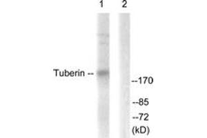 Image no. 1 for anti-Tuberous Sclerosis 2 (TSC2) (AA 905-954) antibody (ABIN1532423)