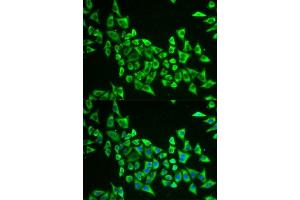 Image no. 3 for anti-Mitochondrial Ribosomal Protein S30 (MRPS30) antibody (ABIN6144043)