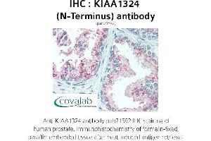 Image no. 2 for anti-Endosome/Lysosome-associated Apoptosis and Autophagy Regulator 1 (ELAPOR1) (N-Term) antibody (ABIN1736216)