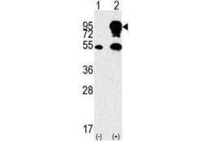 Image no. 2 for anti-Small Nuclear Ribonucleoprotein Polypeptide E (SNRPE) antibody (ABIN3003507)