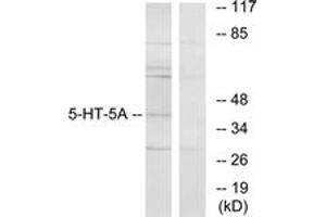Image no. 1 for anti-Serotonin Receptor 5A (HTR5A) (AA 211-260) antibody (ABIN1534247)