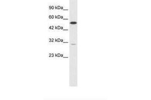 Image no. 1 for anti-Hepatocyte Nuclear Factor 4 gamma (HNF4G) (C-Term) antibody (ABIN6735846)