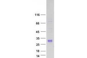 Image no. 1 for Ribonuclease, RNase A Family, 10 (Non-Active) (RNASE10) protein (Myc-DYKDDDDK Tag) (ABIN2730988)
