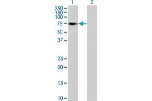 Image no. 1 for anti-Suppressor of Cytokine Signaling 6 (SOCS6) (AA 1-535) antibody (ABIN1327679)