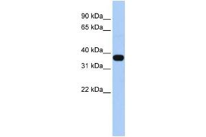 anti-Mitochondrial E3 Ubiquitin Protein Ligase 1 (MUL1) (Middle Region) antibody