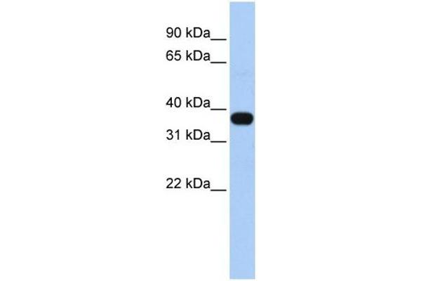 anti-Mitochondrial E3 Ubiquitin Protein Ligase 1 (MUL1) (Middle Region) antibody