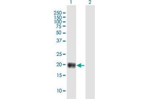 TMEM86B antibody  (AA 1-226)