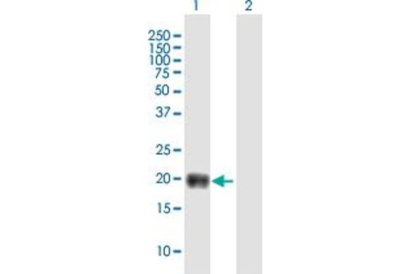 TMEM86B antibody  (AA 1-226)