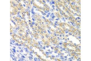 Immunohistochemistry of paraffin-embedded Rat kidney using SURF1 Polyclonal Antibody at dilution of 1:100 (40x lens).