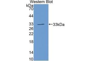 Image no. 4 for Growth Differentiation Factor 11 (GDF11) ELISA Kit (ABIN6720581)