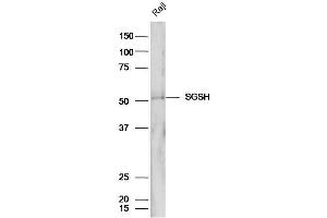 Image no. 1 for anti-N-Sulfoglucosamine Sulfohydrolase (SGSH) (AA 301-388) antibody (ABIN1386573)