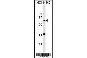 Image no. 1 for anti-PET112 Homolog (PET112) (AA 34-61), (N-Term) antibody (ABIN1539305)
