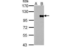 Image no. 1 for anti-Forkhead Box M1 (FOXM1) (Center) antibody (ABIN2855309)