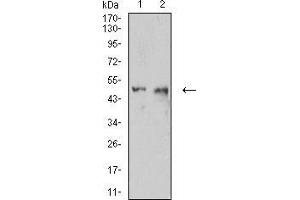 Image no. 1 for anti-Intercellular Adhesion Molecule 1 (ICAM1) (AA 28-163) antibody (ABIN5684112)