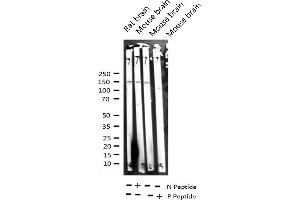 Image no. 2 for anti-Mitogen-Activated Protein Kinase Kinase Kinase 5 (MAP3K5) (pSer966) antibody (ABIN6255571)