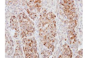 IHC-P Image Immunohistochemical analysis of paraffin-embedded A549 xenograft, using ECT2, antibody at 1:100 dilution.