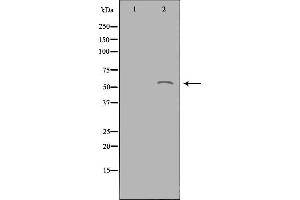 Image no. 2 for anti-Acyl-CoA Thioesterase 2 (ACOT2) antibody (ABIN6257739)