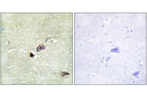Image no. 2 for anti-Tripartite Motif Containing 59 (TRIM59) (AA 191-240) antibody (ABIN1533991)