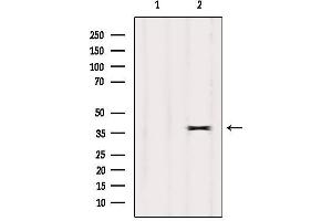 Image no. 3 for anti-Olfactory Receptor, Family 7, Subfamily E, Member 24 (OR7E24) antibody (ABIN6259544)