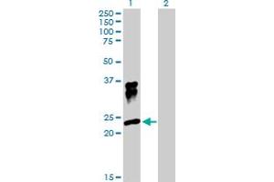 Image no. 1 for anti-Orosomucoid 1 (ORM1) (AA 1-201) antibody (ABIN518543)
