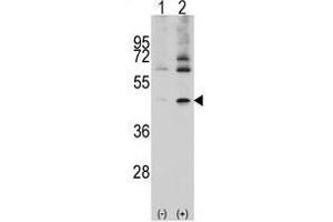Image no. 2 for anti-Actin, Alpha, Cardiac Muscle 1 (ACTC1) (Center) antibody (ABIN357023)