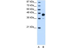 Image no. 2 for anti-Homeobox C10 (HOXC10) (N-Term) antibody (ABIN2781021)
