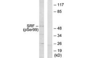 Western blot analysis of extracts from LOVO cells treated with Serum 10% 15', using SRF (Phospho-Ser99) Antibody.
