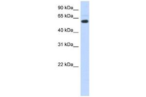 Image no. 1 for anti-Chromodomain Protein, Y-Like (CDYL) (N-Term) antibody (ABIN630672)
