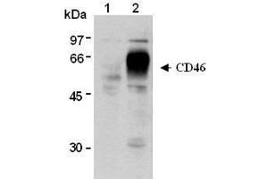 Image no. 3 for anti-CD46 (CD46) antibody (ABIN1449263)
